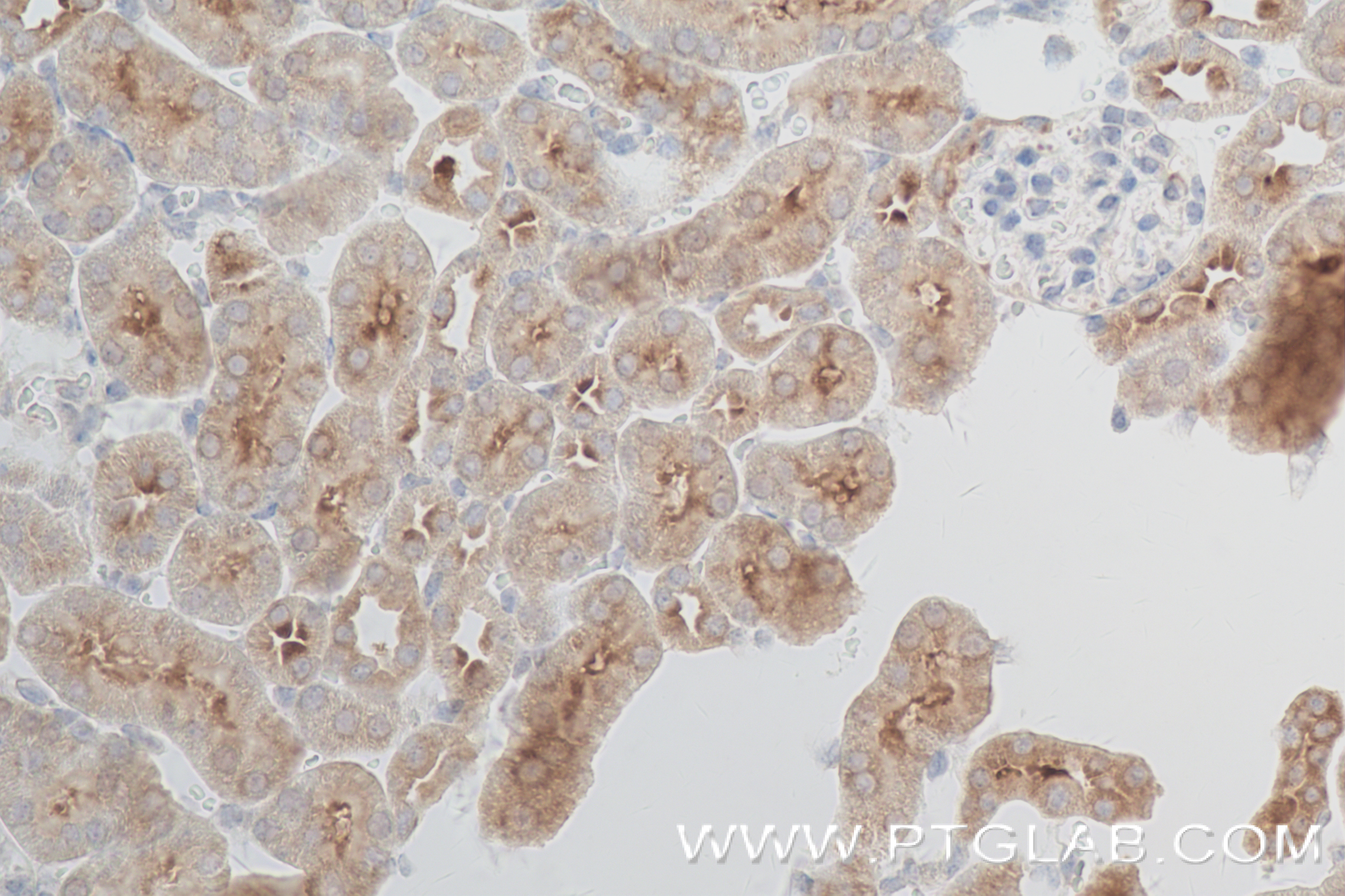 IHC staining of mouse kidney using 84268-1-RR (same clone as 84268-1-PBS)