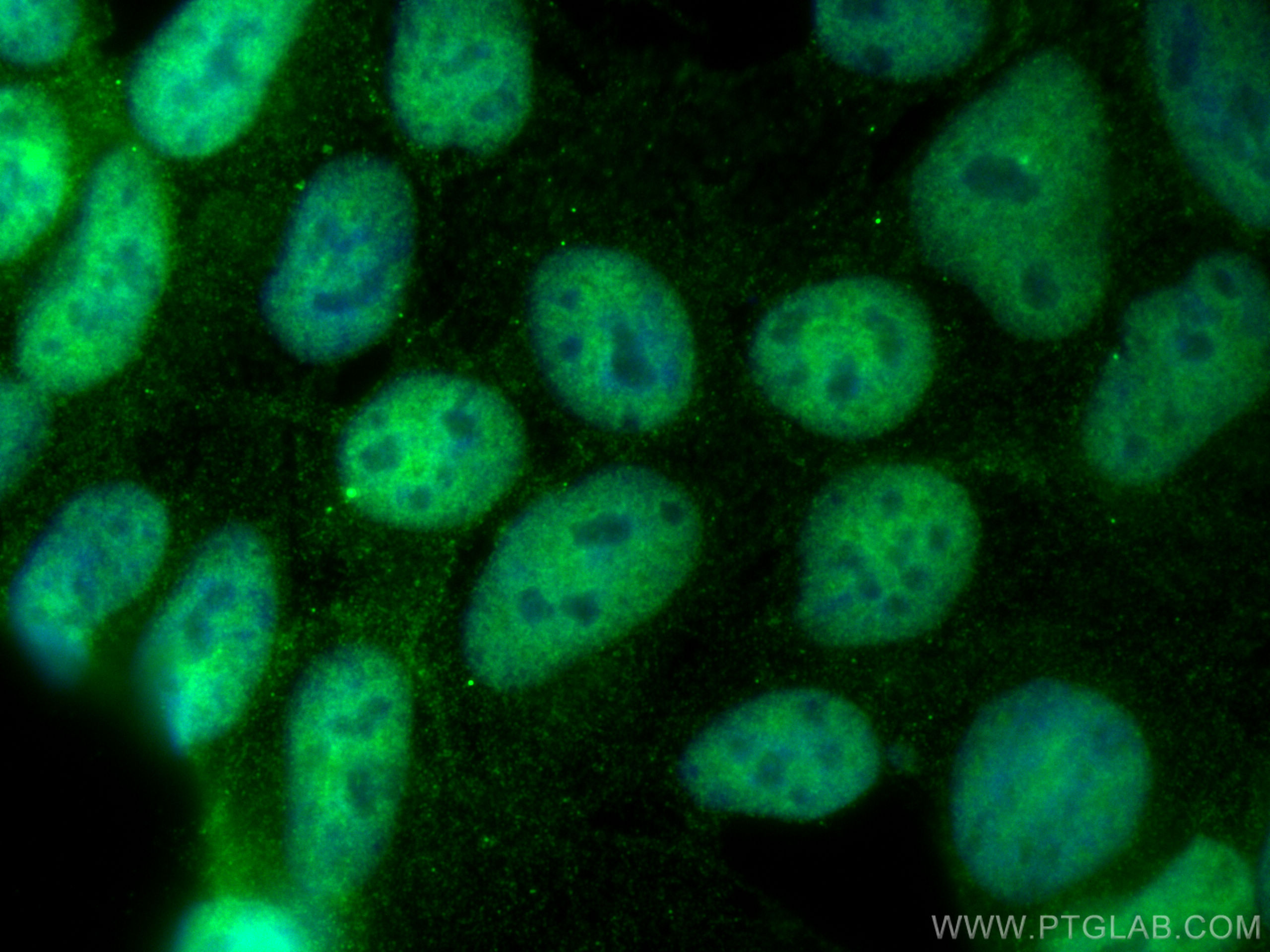 IF Staining of HEK-293 using 16943-1-AP