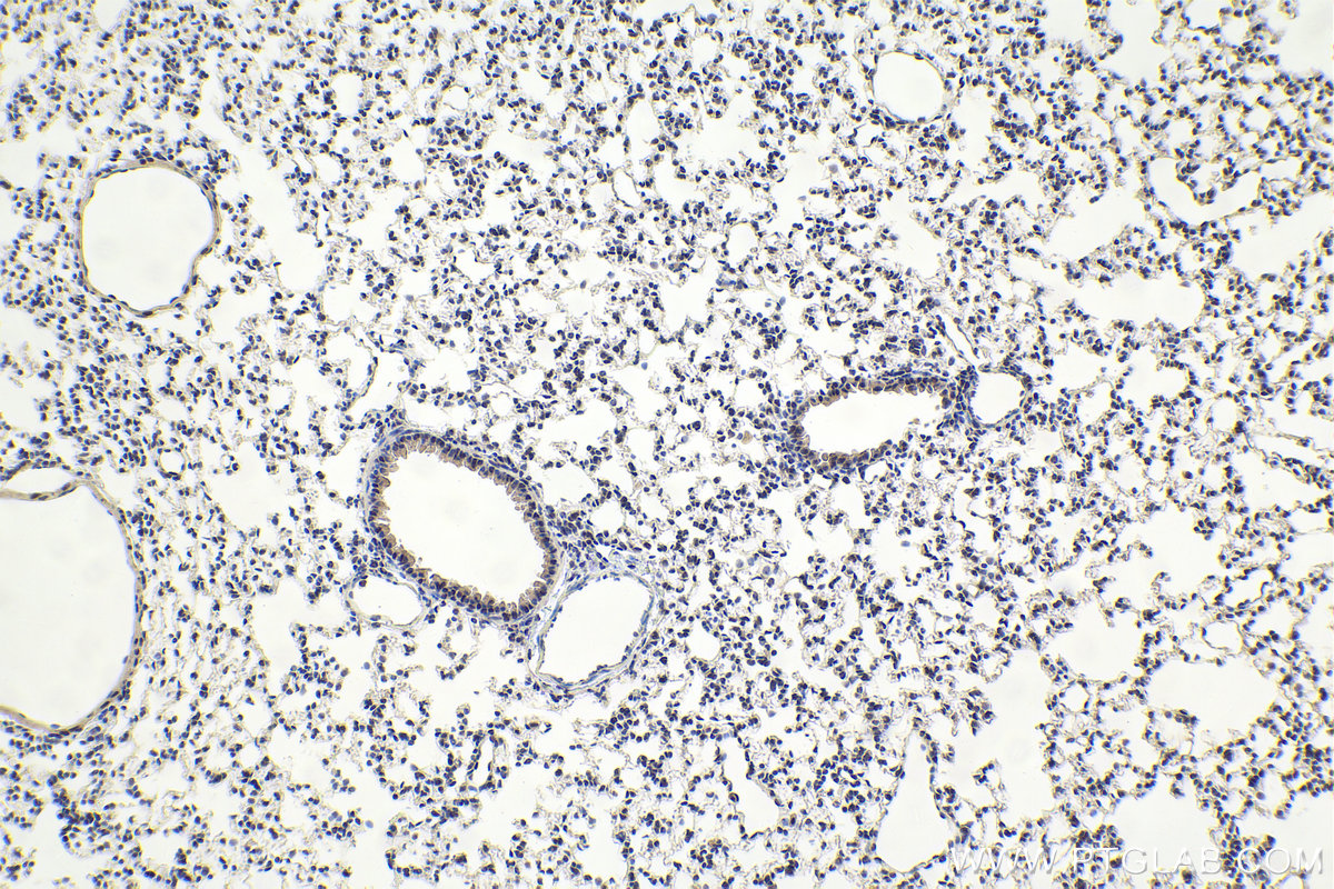 IHC staining of mouse lung using 16943-1-AP