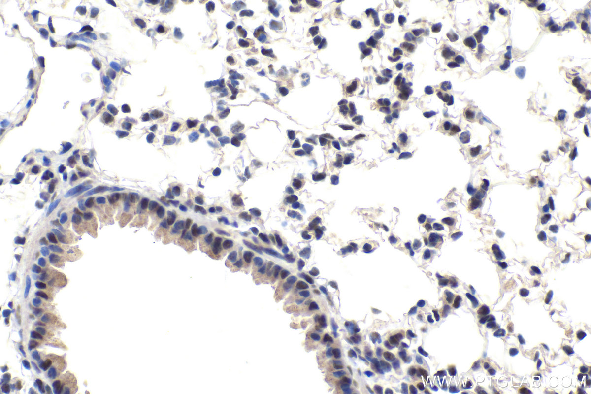 IHC staining of mouse lung using 16943-1-AP