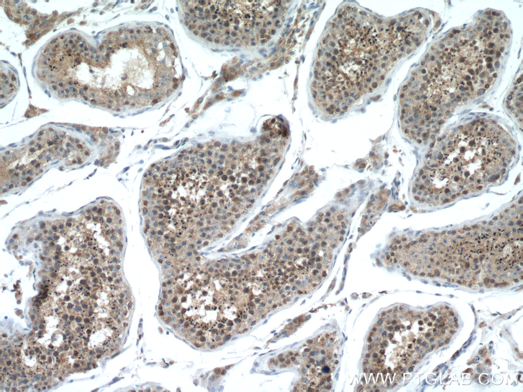 IHC staining of human testis using 13296-1-AP