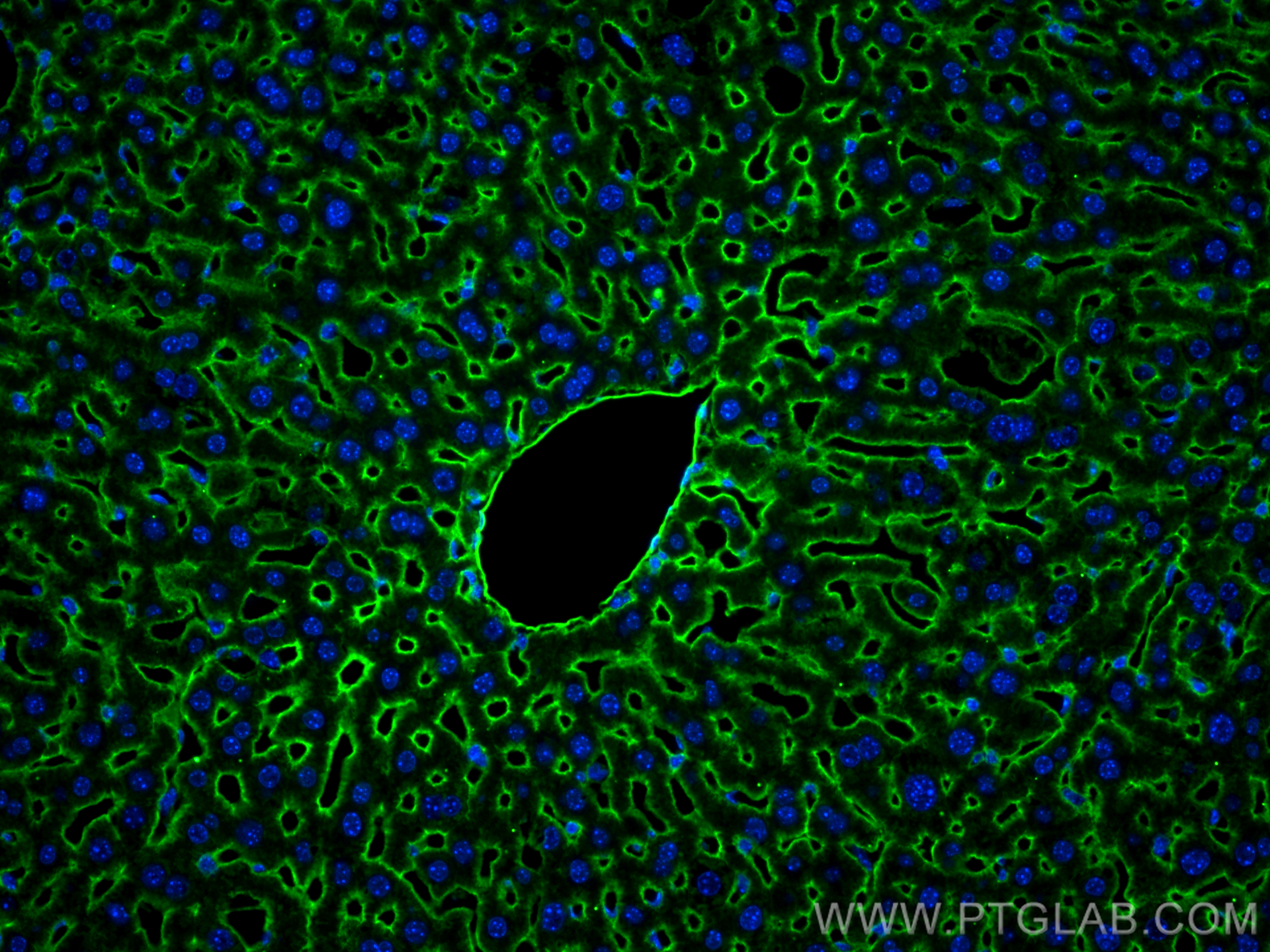 IF Staining of mouse liver using 30324-1-AP