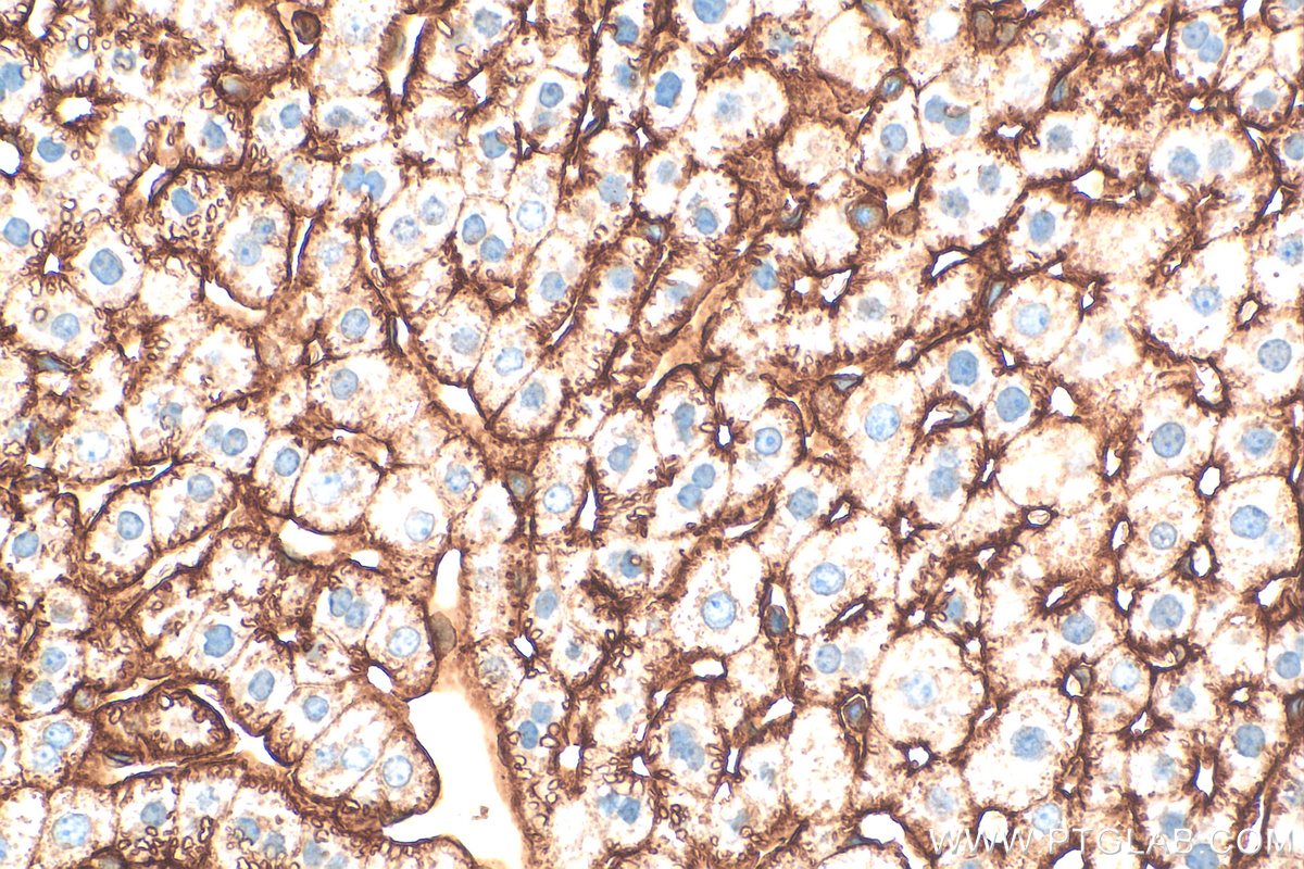 IHC staining of mouse liver using 30324-1-AP