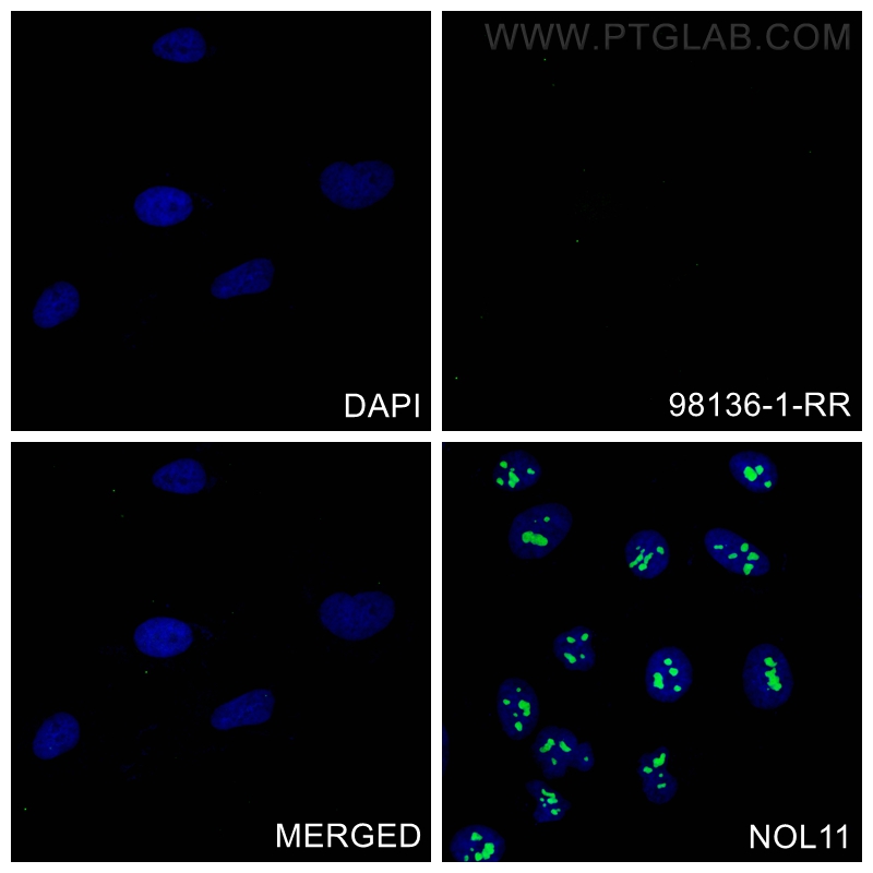 IF Staining of HeLa using 98136-1-RR (same clone as 98136-1-PBS)