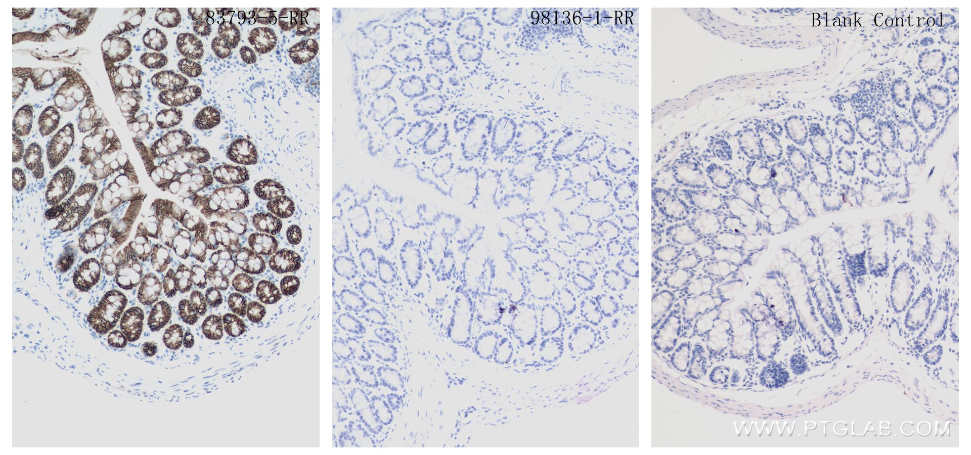 IHC staining of mouse colon using 98136-1-RR (same clone as 98136-1-PBS)