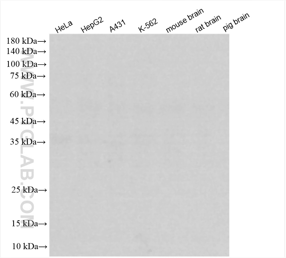 WB analysis using 98136-1-RR (same clone as 98136-1-PBS)