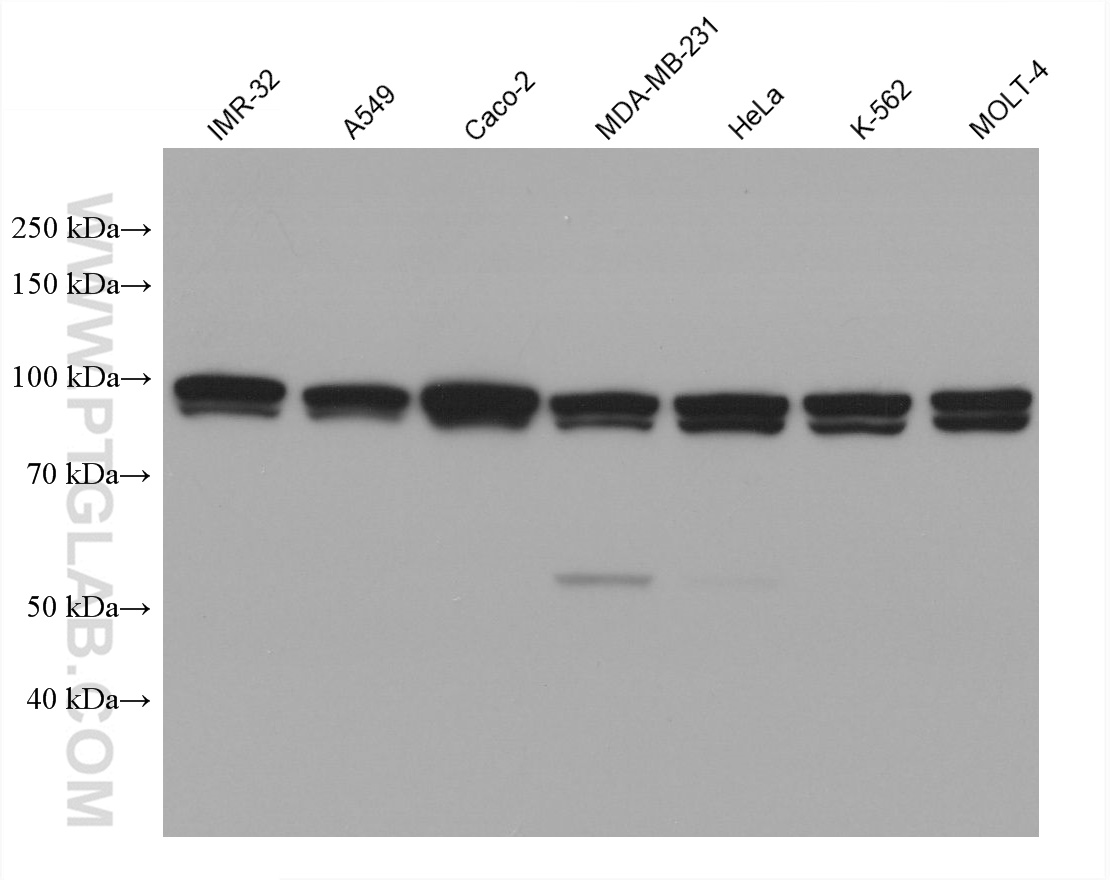 WB analysis using 67597-1-Ig