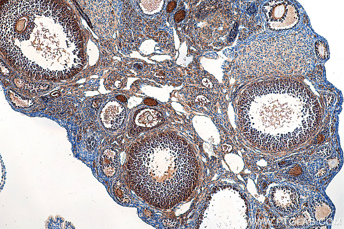 IHC staining of mouse ovary using 27331-1-AP