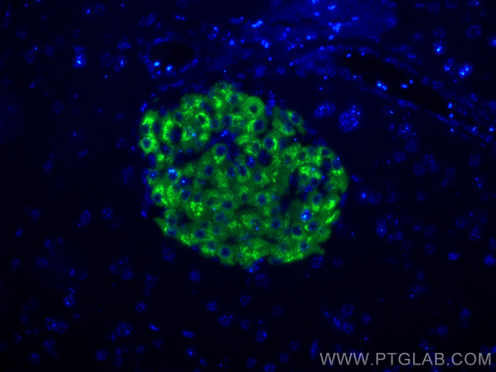 IF Staining of mouse pancreas using 83867-1-RR