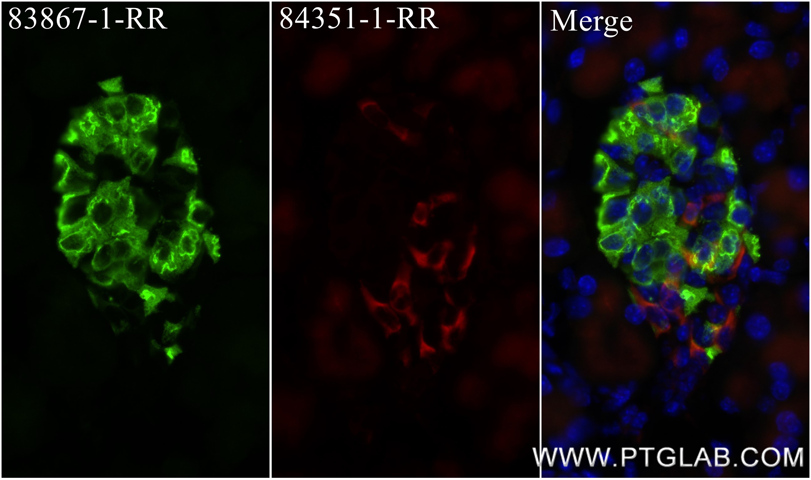 IF Staining of mouse pancreas using 83867-1-RR