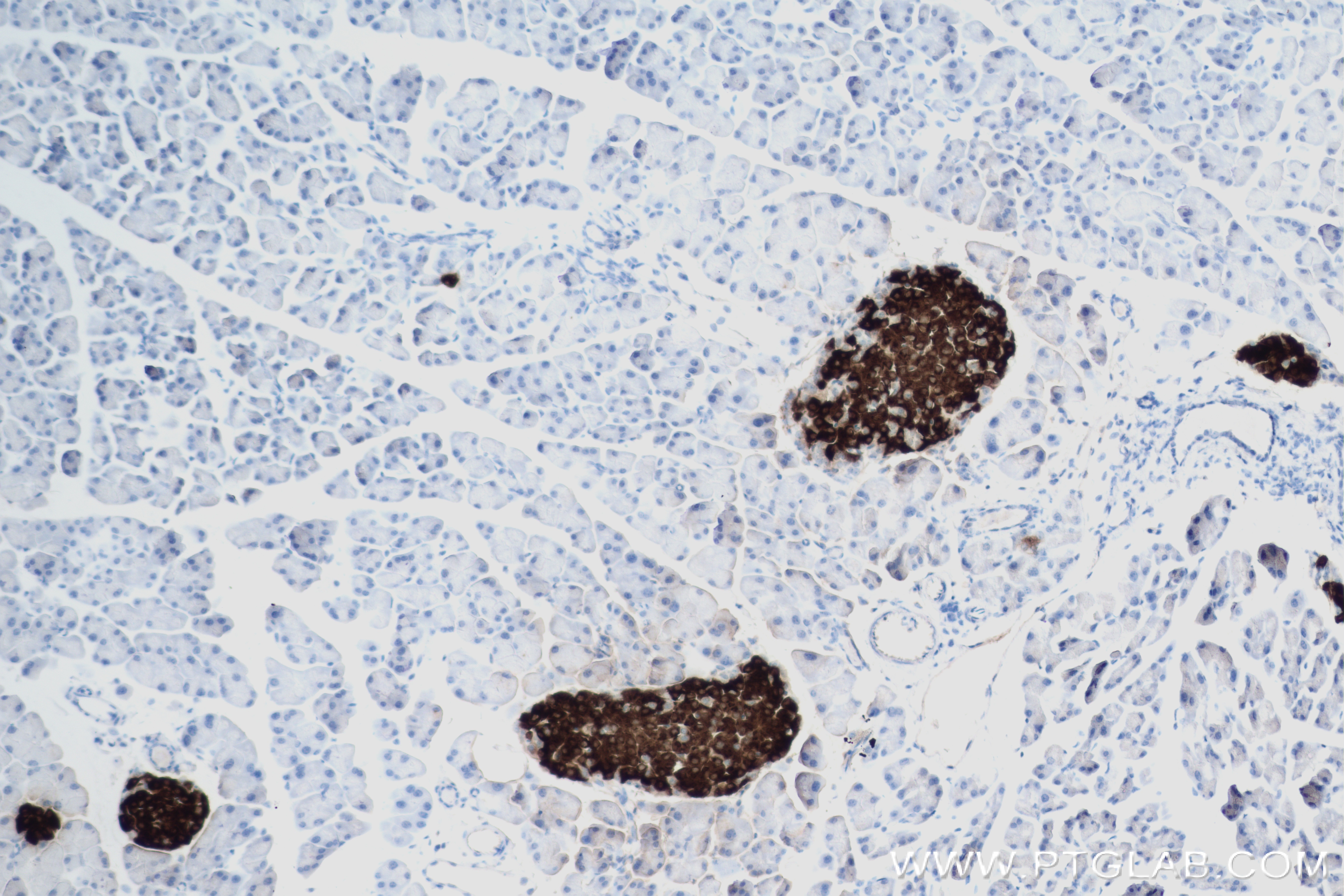 IHC staining of mouse pancreas using 83867-1-RR