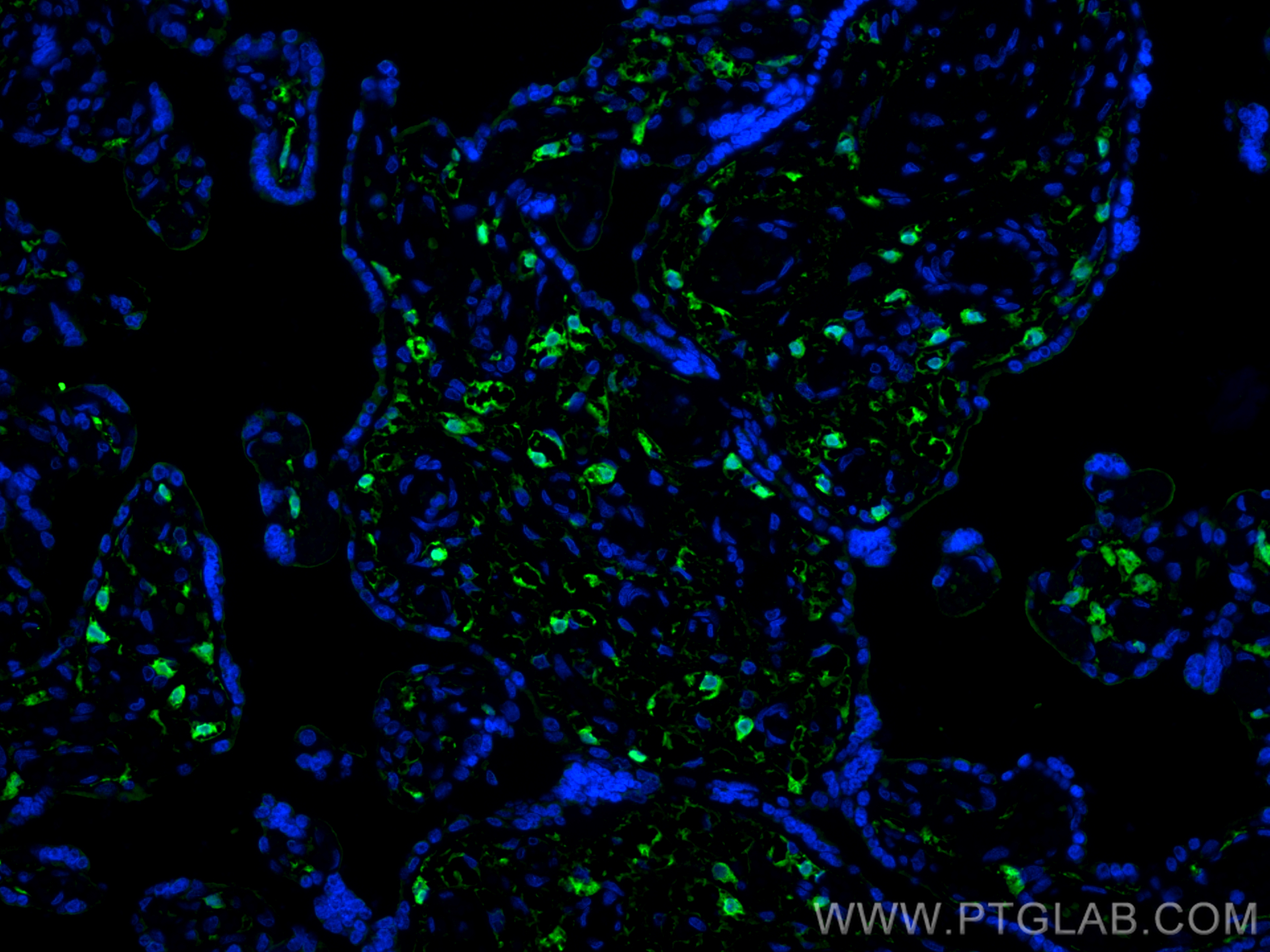 IF Staining of human placenta using 68211-1-Ig (same clone as 68211-1-PBS)