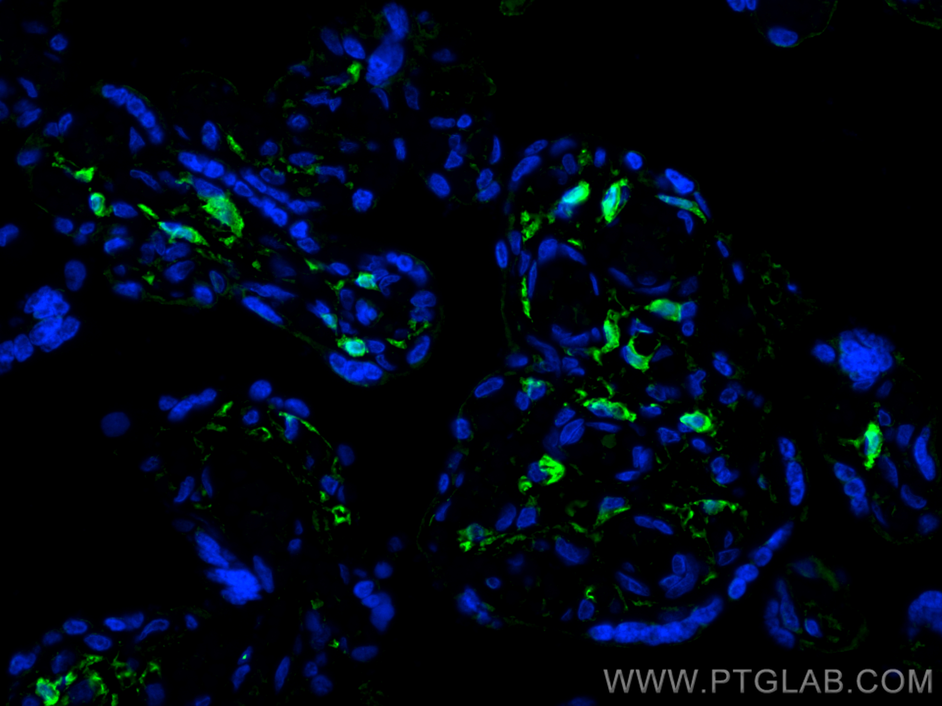 IF Staining of human placenta using 68211-1-Ig (same clone as 68211-1-PBS)