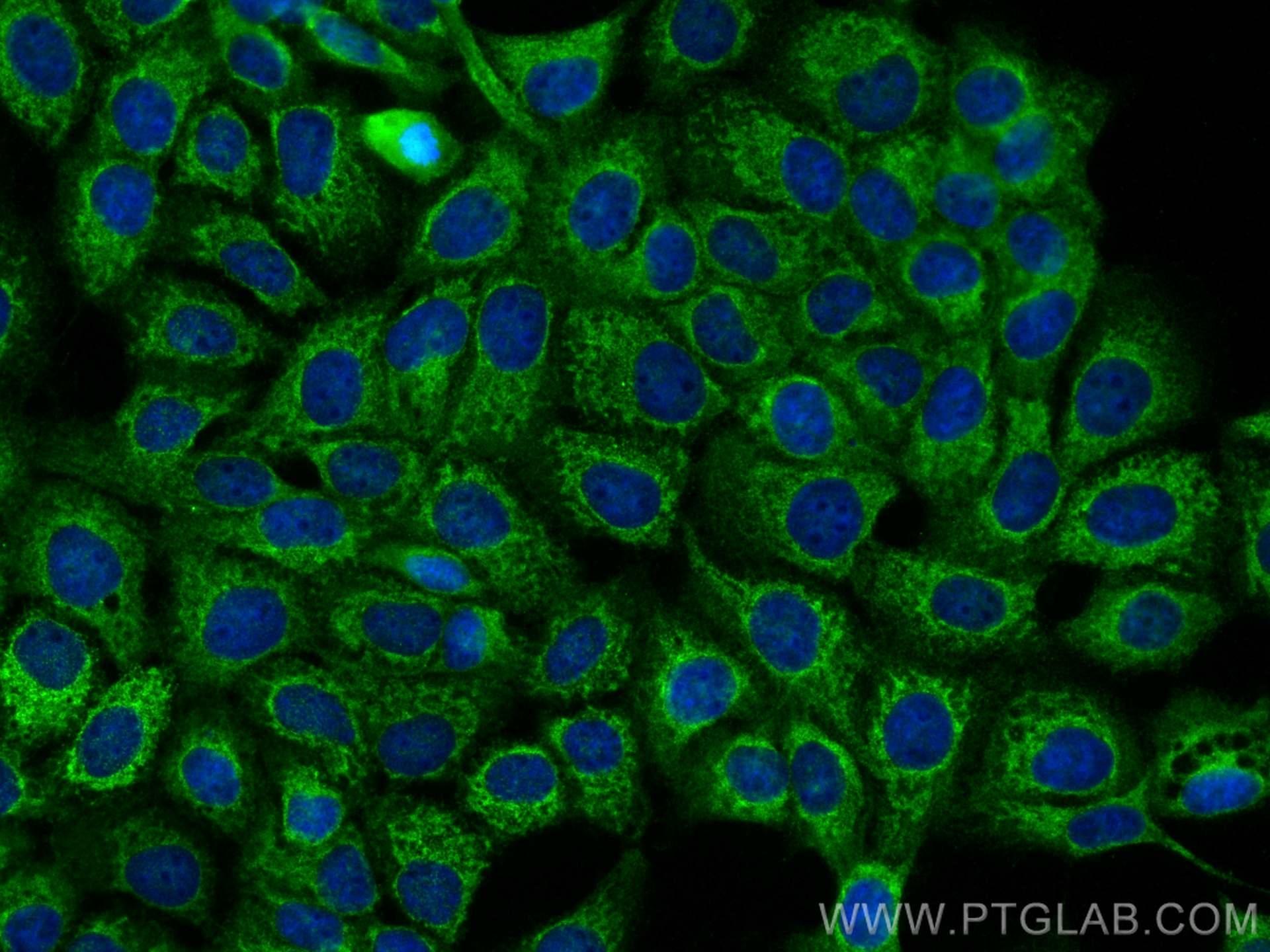 IF Staining of A431 using 30703-1-AP