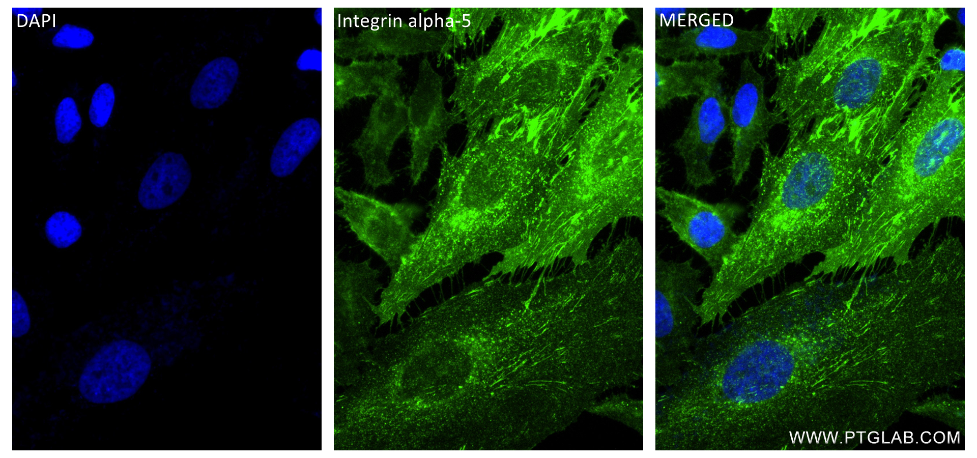 IF Staining of HeLa using 84468-4-RR (same clone as 84468-4-PBS)