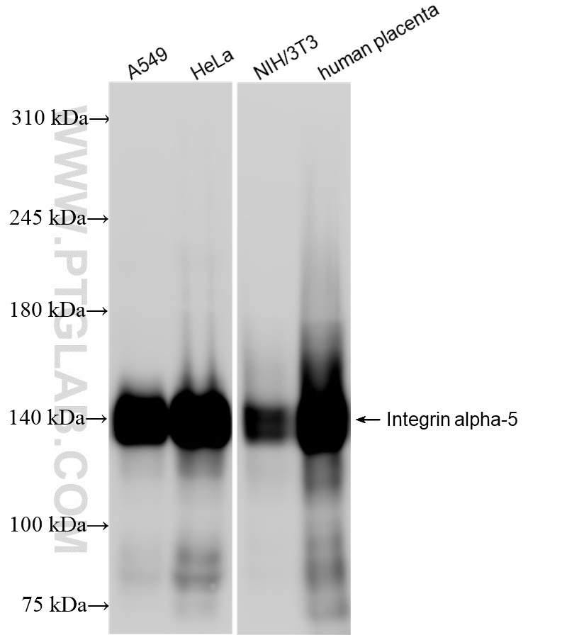 Integrin alpha-5