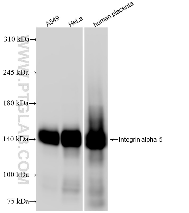 Integrin alpha-5