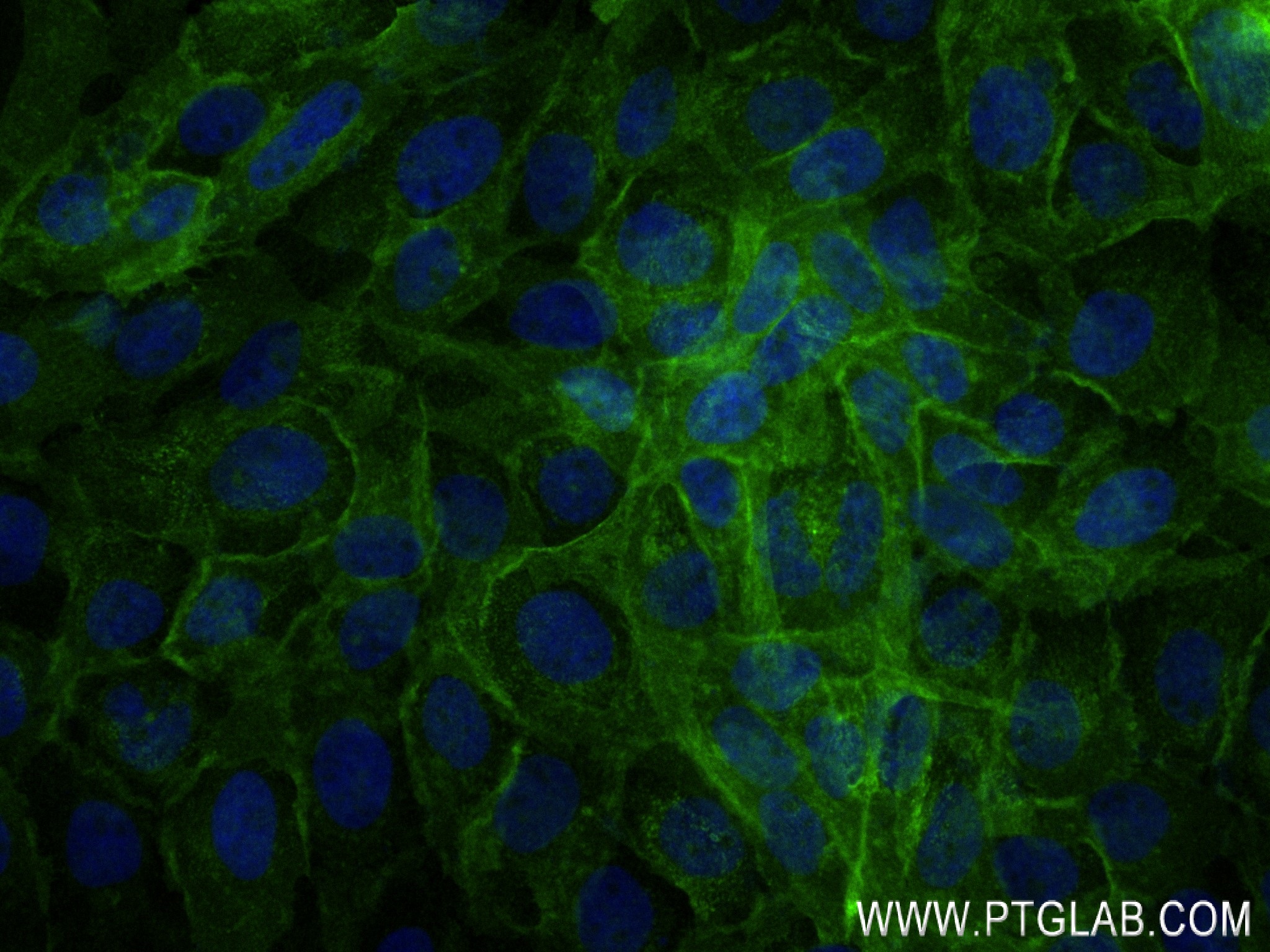 IF Staining of A431 using 84463-3-RR