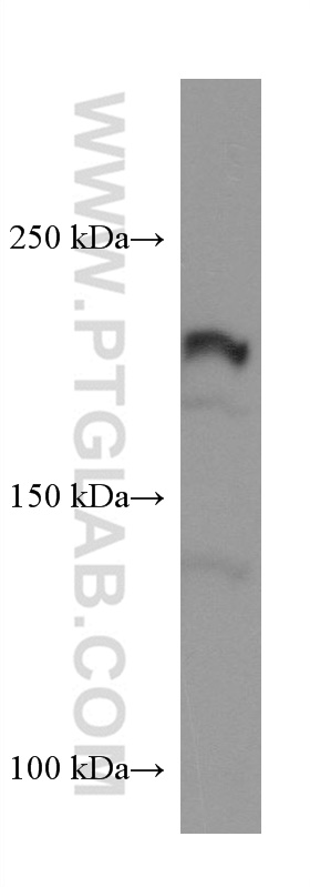 Integrin Beta 4