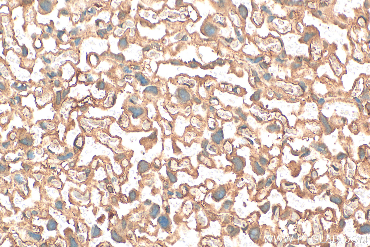 IHC staining of mouse placenta using 28543-1-AP