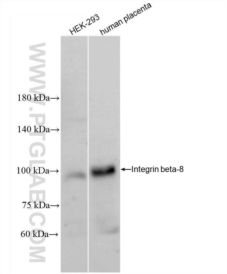 WB analysis using 84558-1-RR (same clone as 84558-1-PBS)