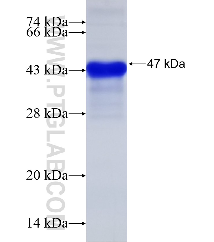 Integrin beta-8 fusion protein Ag31137 SDS-PAGE