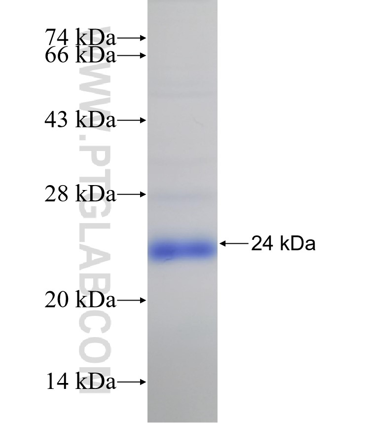 Integrin beta-8 fusion protein Ag31161 SDS-PAGE