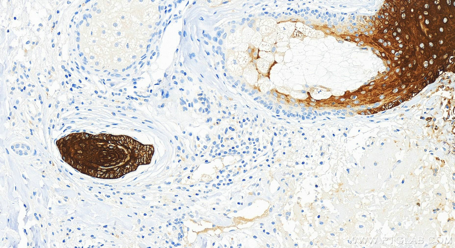 IHC staining of human skin using 83649-5-RR