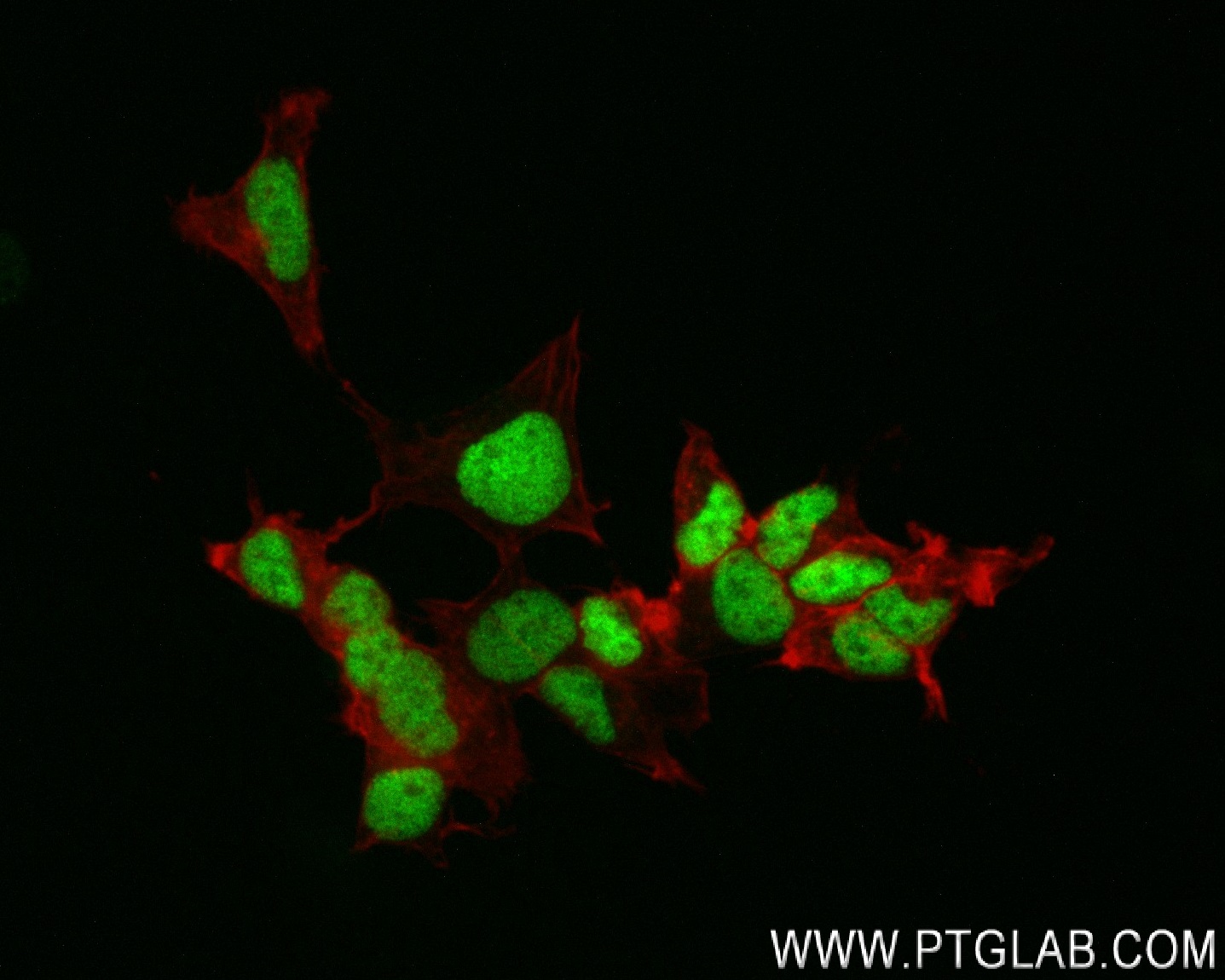 IF Staining of SH-SY5Y using 83784-4-RR (same clone as 83784-4-PBS)