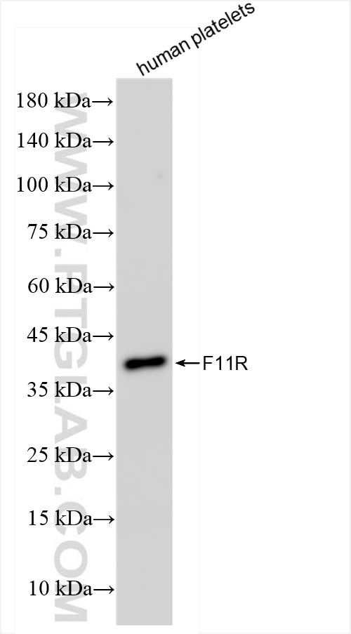 WB analysis of human peripheral blood platelets using 84720-2-RR (same clone as 84720-2-PBS)