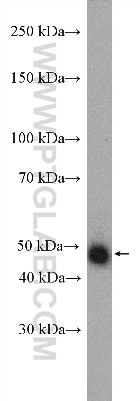 WB analysis of HeLa using 21572-1-AP