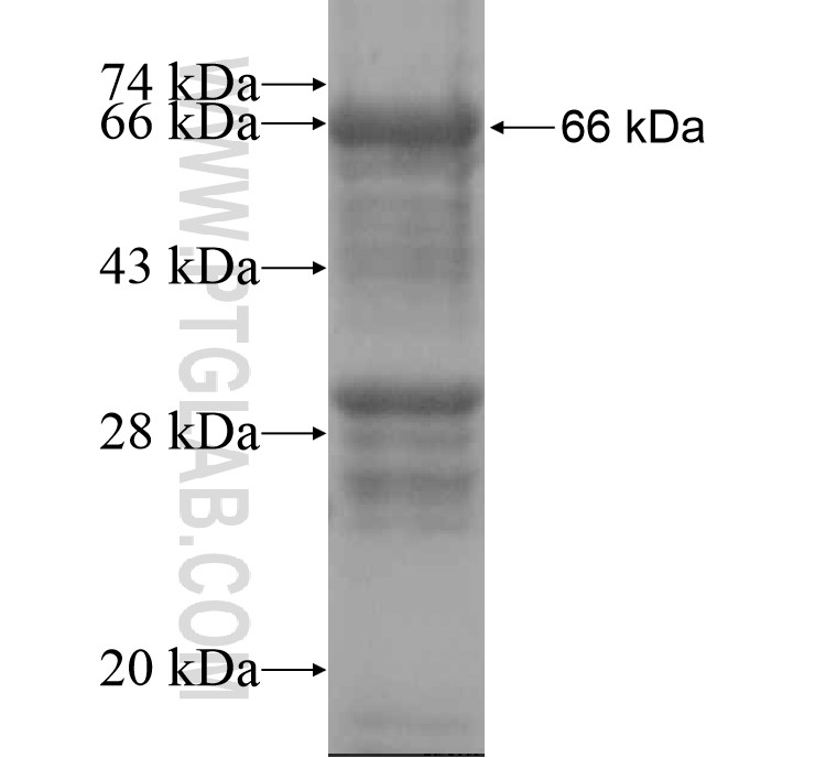 JMJD5 fusion protein Ag15115 SDS-PAGE