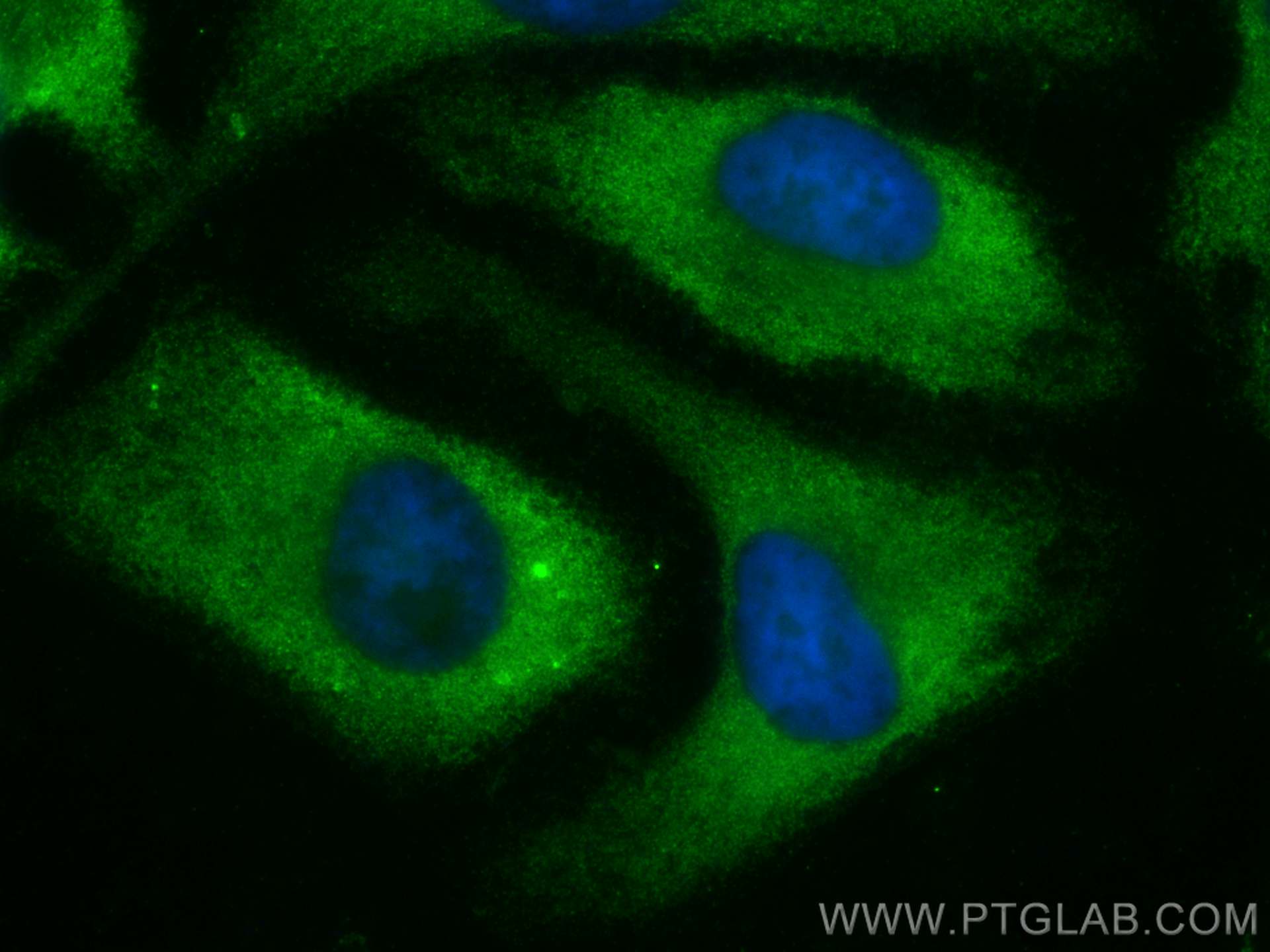 IF Staining of HeLa using 25098-1-AP