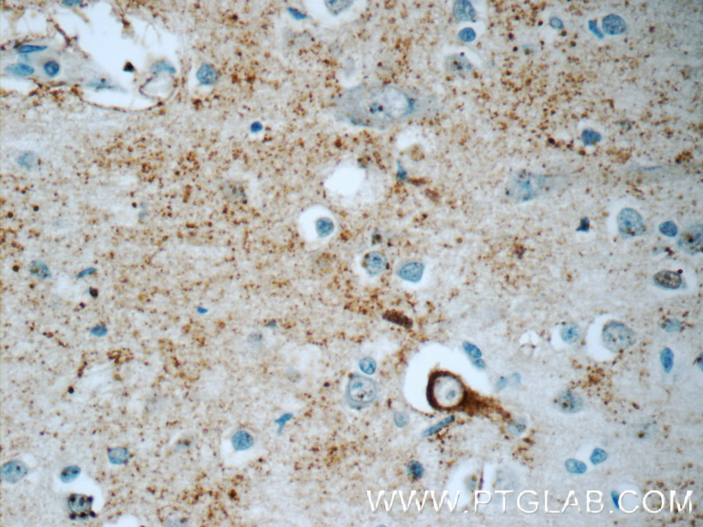 IHC staining of human brain using 25098-1-AP