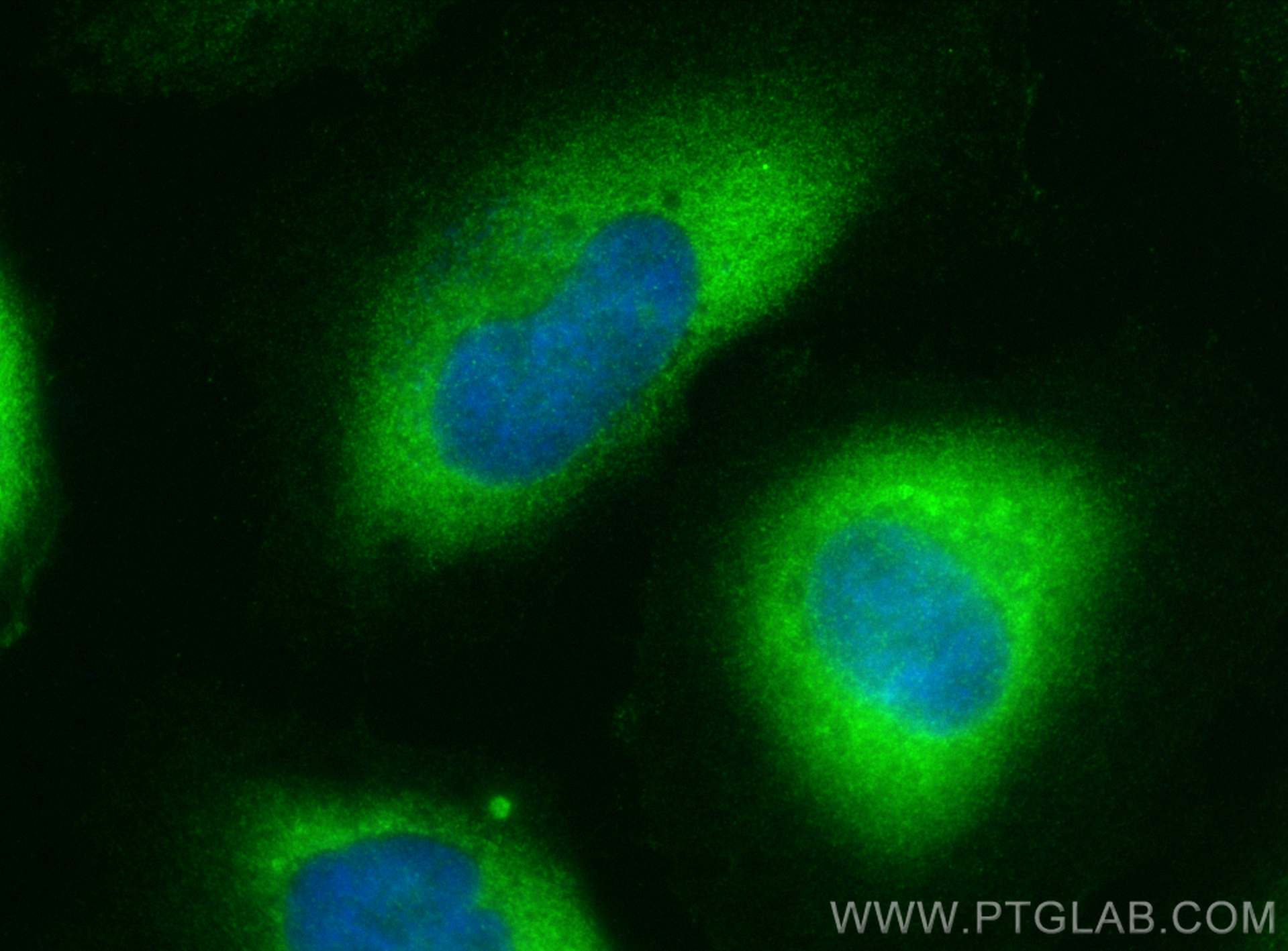 IF Staining of HeLa using 10424-1-AP