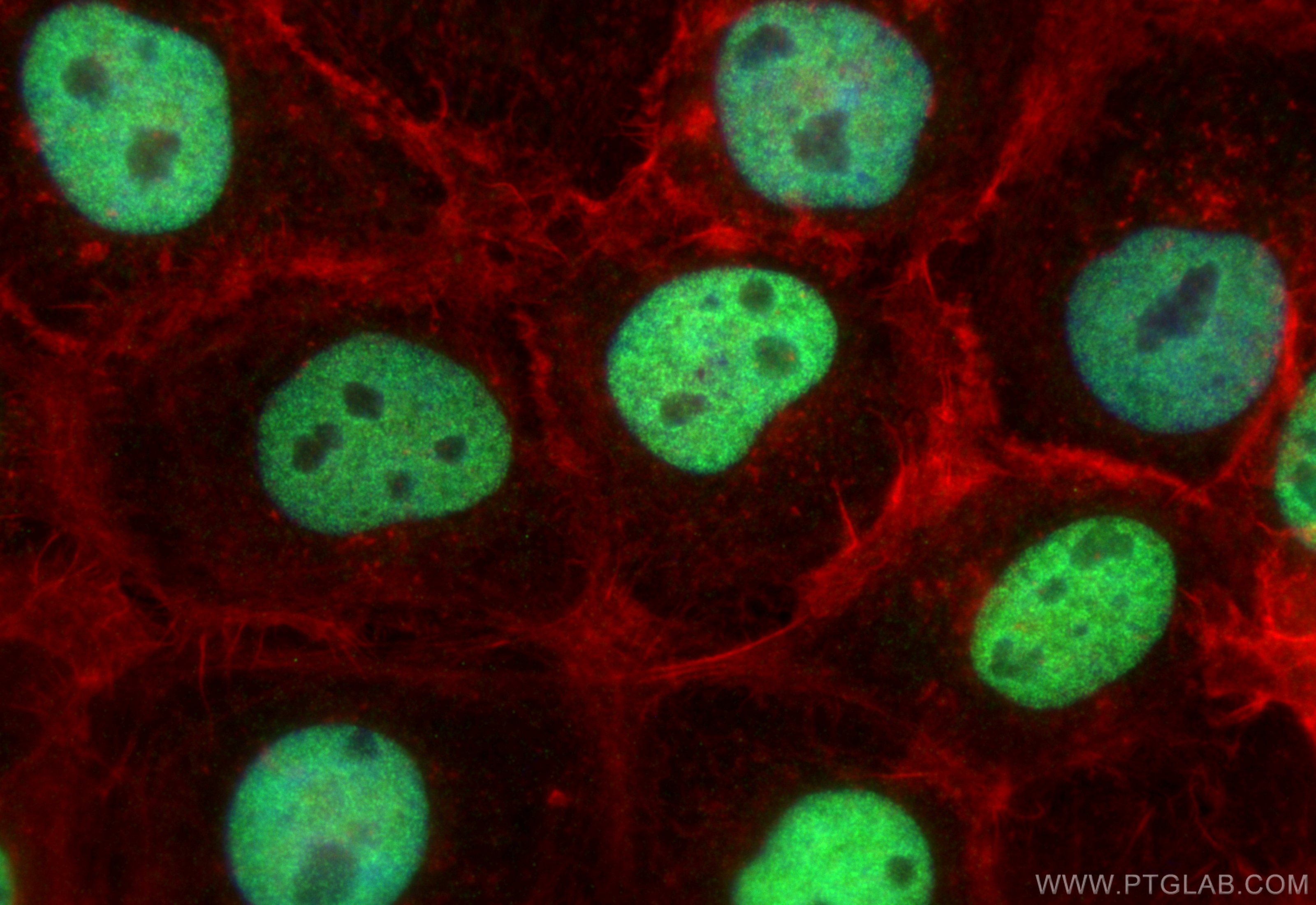 IF Staining of A431 using 10486-1-AP