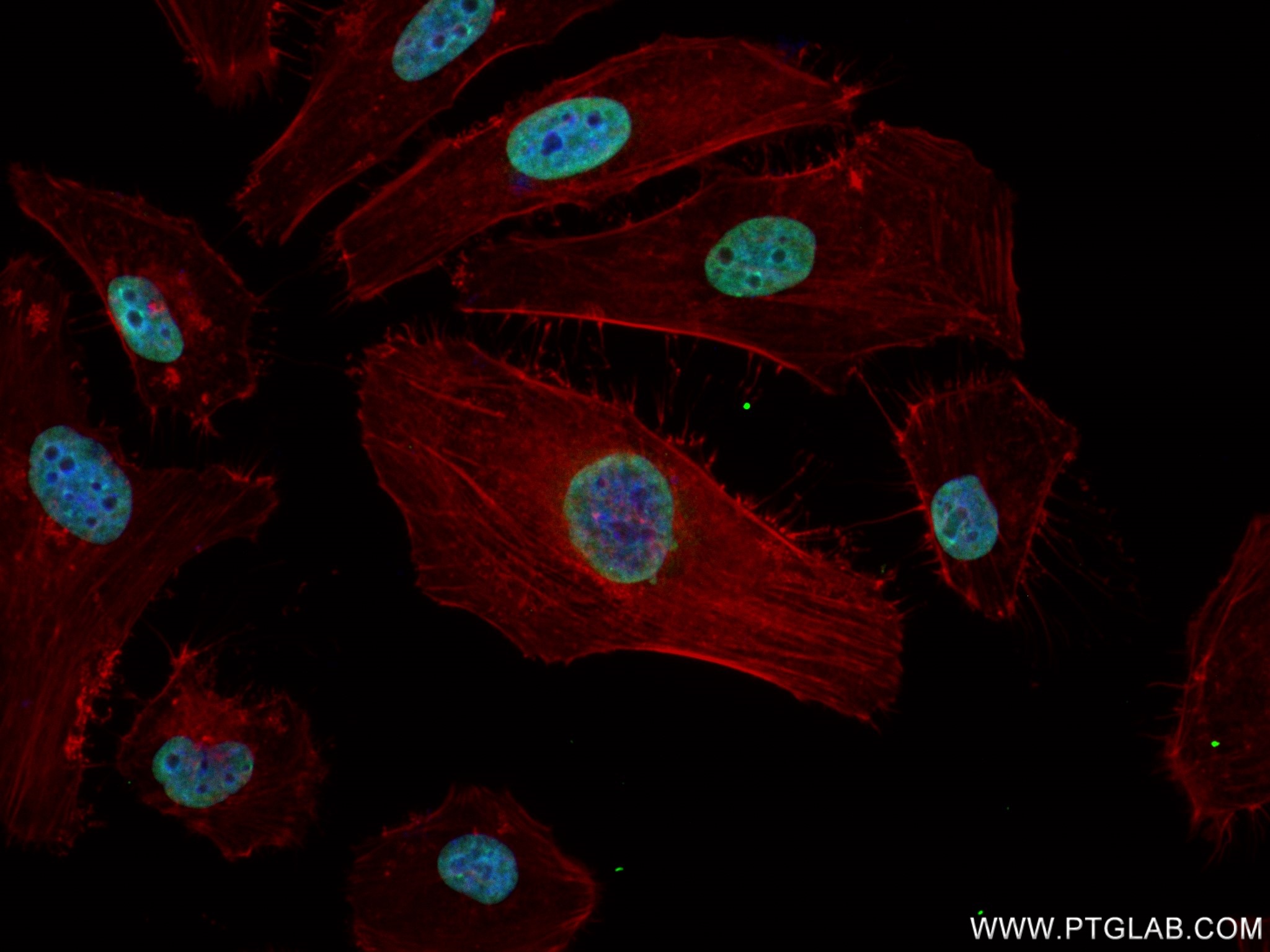 IF Staining of HeLa using 83134-6-RR