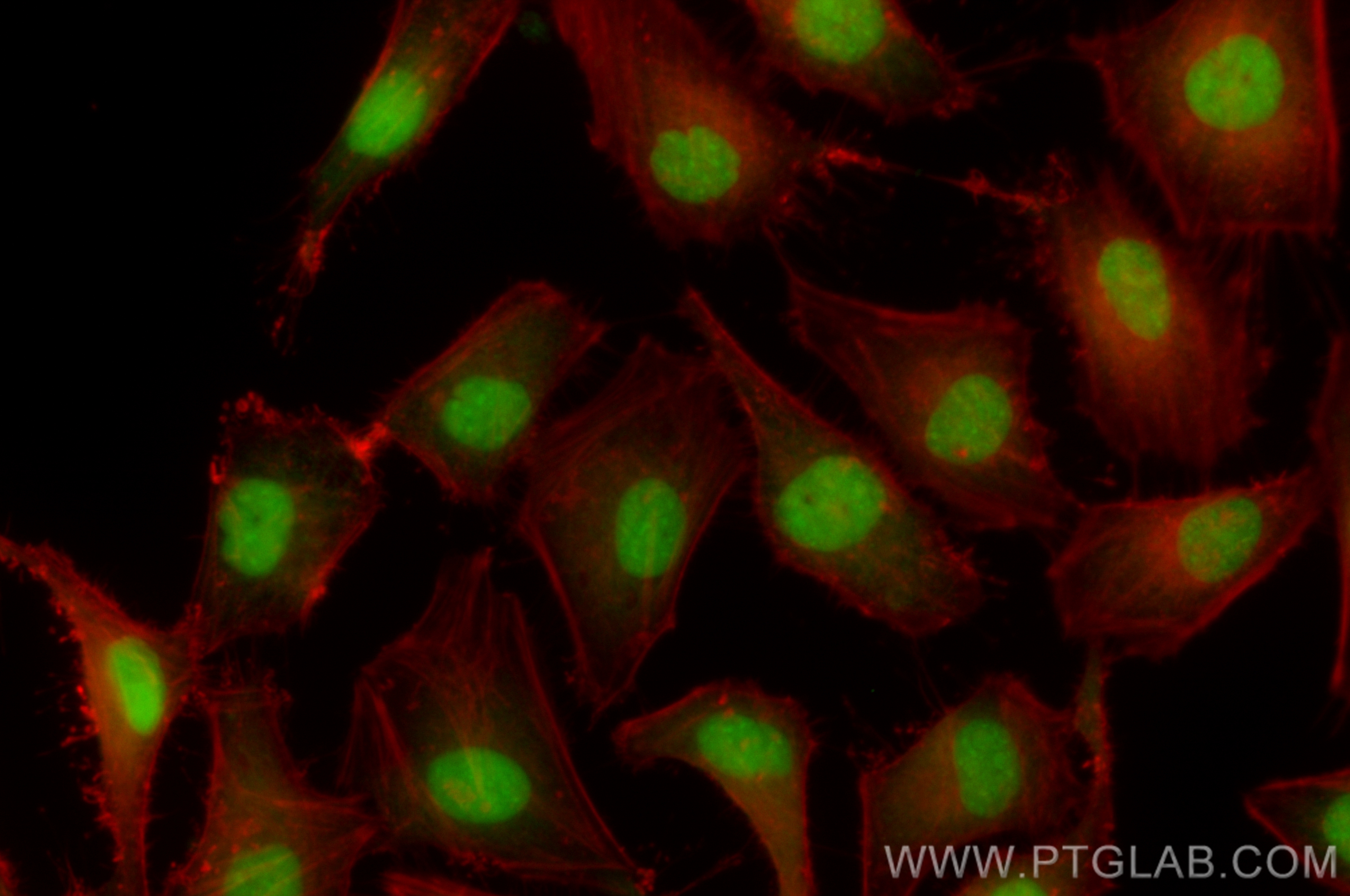 IF Staining of HeLa using CL488-83134-6