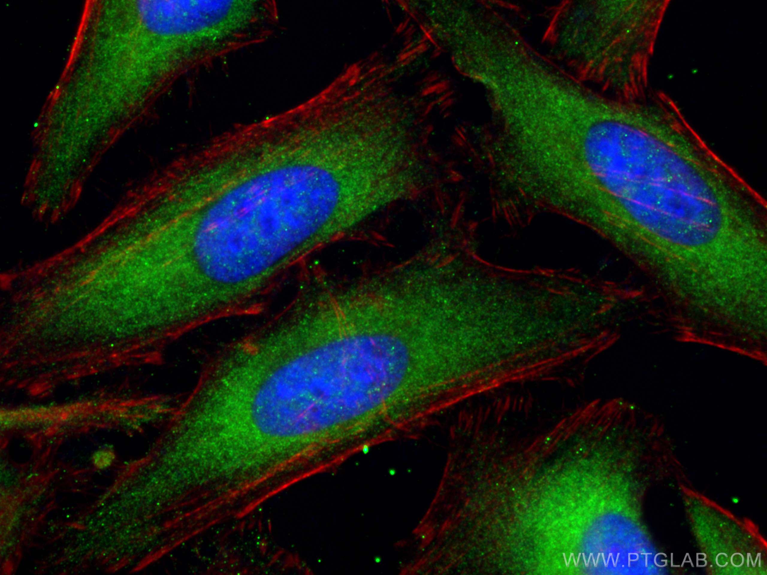 IF Staining of HeLa using 20546-1-AP