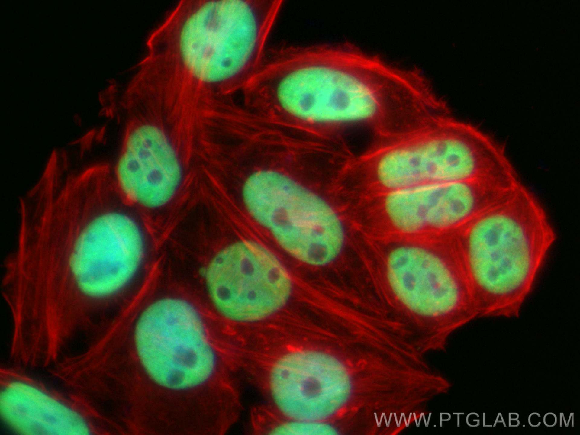 IF Staining of HepG2 using 66630-1-Ig (same clone as 66630-1-PBS)