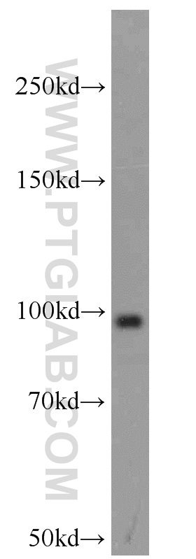 WB analysis of MCF-7 using 14983-1-AP