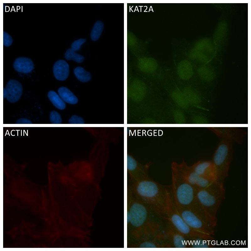 IF Staining of MCF-7 using 84669-2-RR