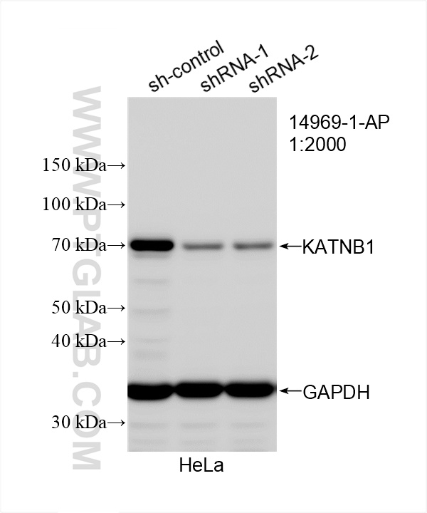 WB analysis of HeLa using 14969-1-AP