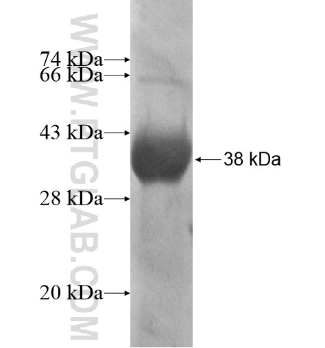 KAZALD1 fusion protein Ag14673 SDS-PAGE