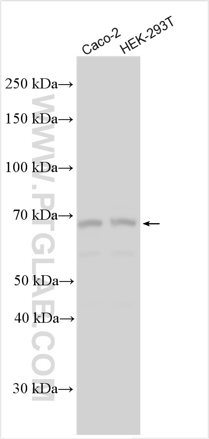 WB analysis using 31778-1-AP