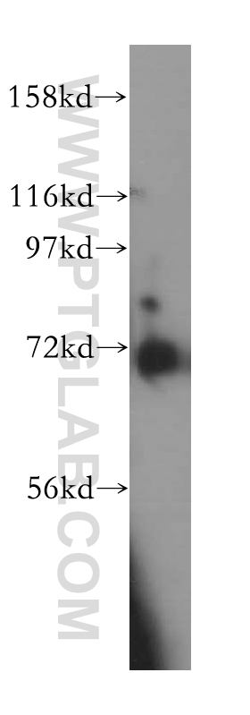 WB analysis of COLO 320 using 13871-1-AP