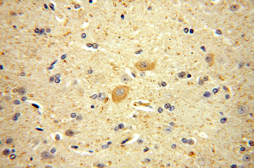 IHC staining of human brain using 14697-1-AP