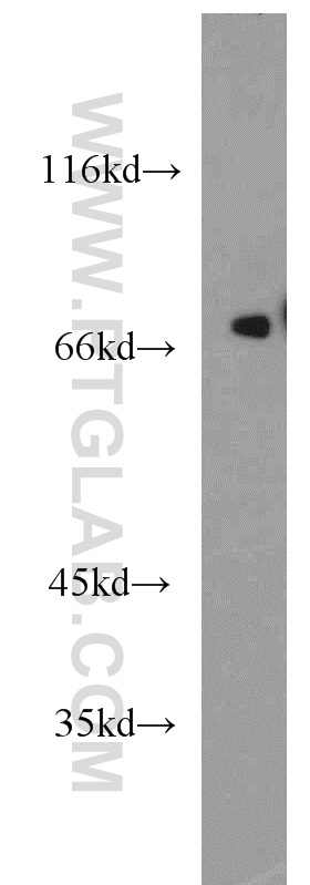 WB analysis of mouse heart using 14697-1-AP