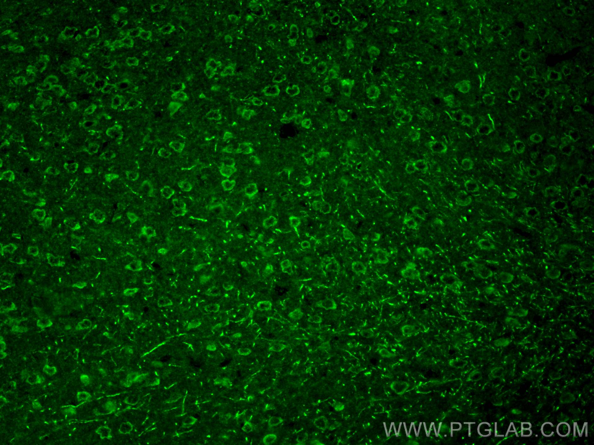 IF Staining of mouse brain using 21298-1-AP