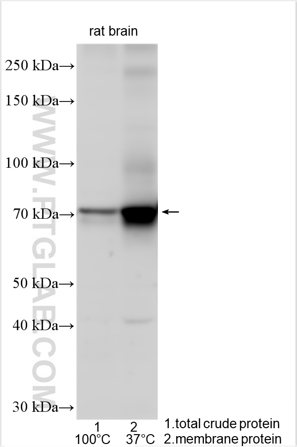 WB analysis using 25468-1-AP